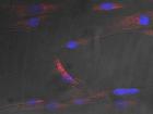 黏附类受体结构和功能研究揭示孤儿GPCR自激活机制