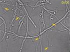 微生物所多维度呈现大丽轮枝菌入侵植物过程